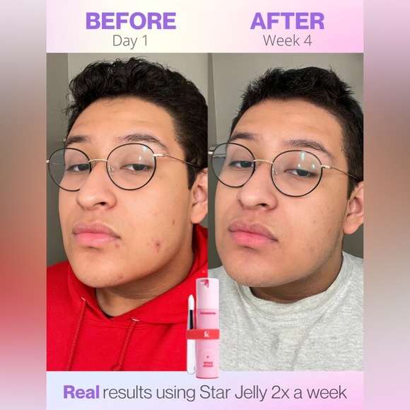 *NWT* kiramoon ⭐️ Star Jelly Mask, Magic Resurfacing Facial (10% AHA + Glycerin) - Picture 7 of 16